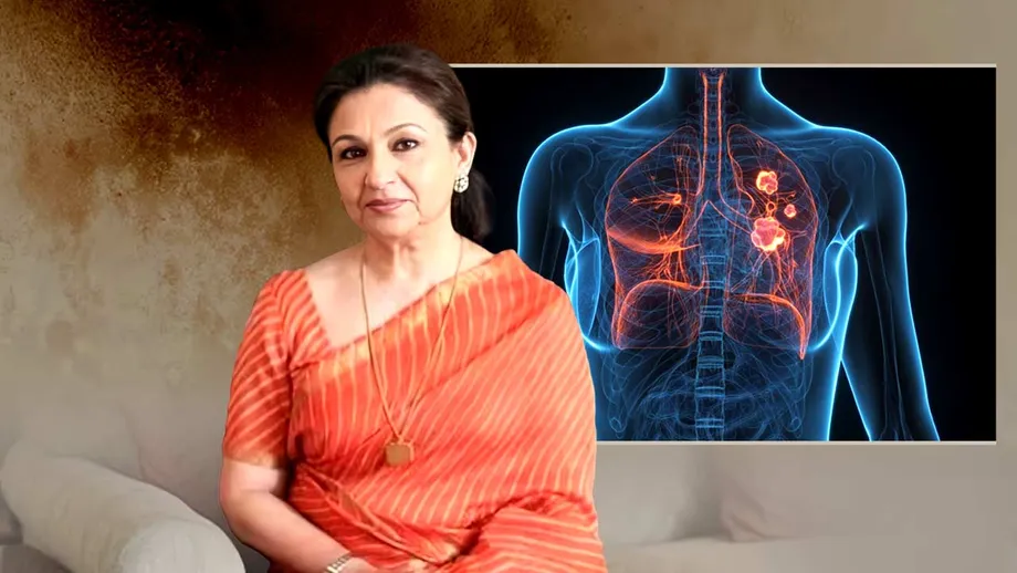 Sharmila Tagore's Stage Zero Lung Cancer Highlights Risks Beyond Smoking